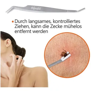 Helperfect Zeckenpinzette Silber