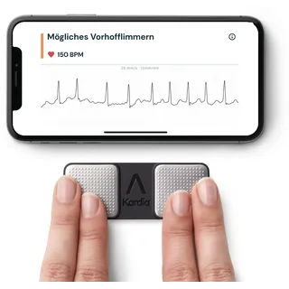 KardiaMobile 1-Kanal-EKG-Herzfrequenzmesser – EKG-Aufzeichnung zu Hause – Erkennt Vorhofflimmern – Sofortige Ergebnisse in 30 Sekunden – Einfach zu verwenden – Funktioniert mit den meisten Smartphones