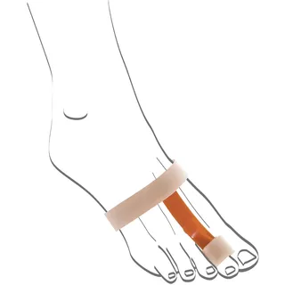 Berkemann Unisex Hammerzehen-korrekturbandage für die Nacht Zehenkappen, Mehrfarbig Beige Orange, Einheitsgröße EU